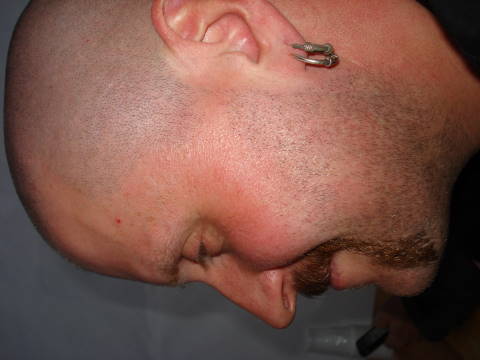 9.SBD_2011.0037